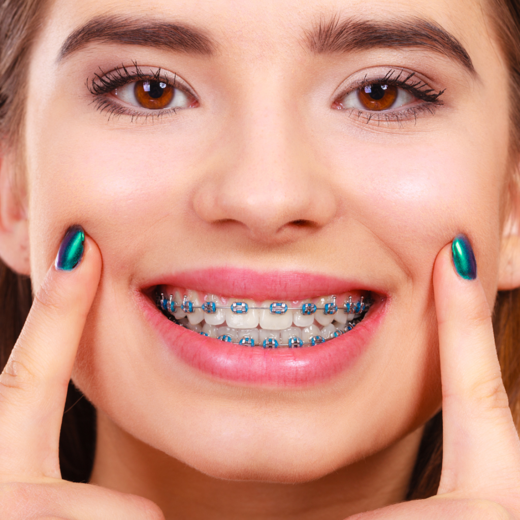 best braces treatment in guwahati