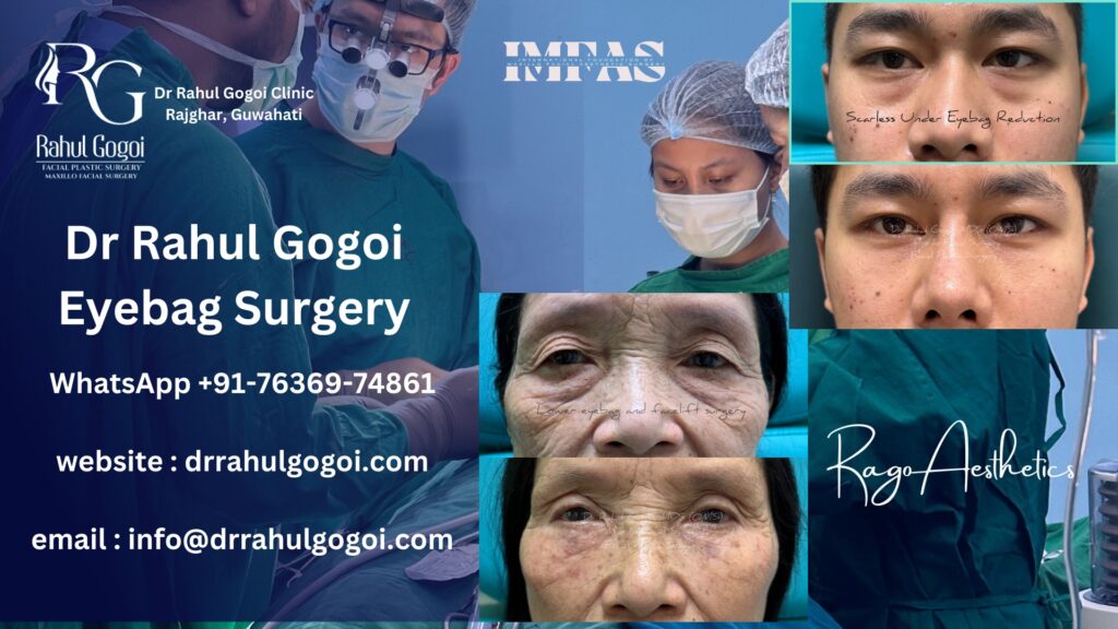best eyebag surgeon in guwahati