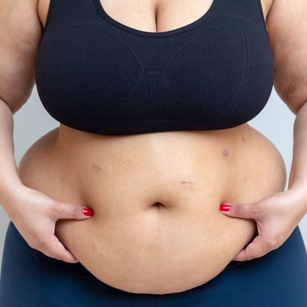 nano fat grafting in guwahati