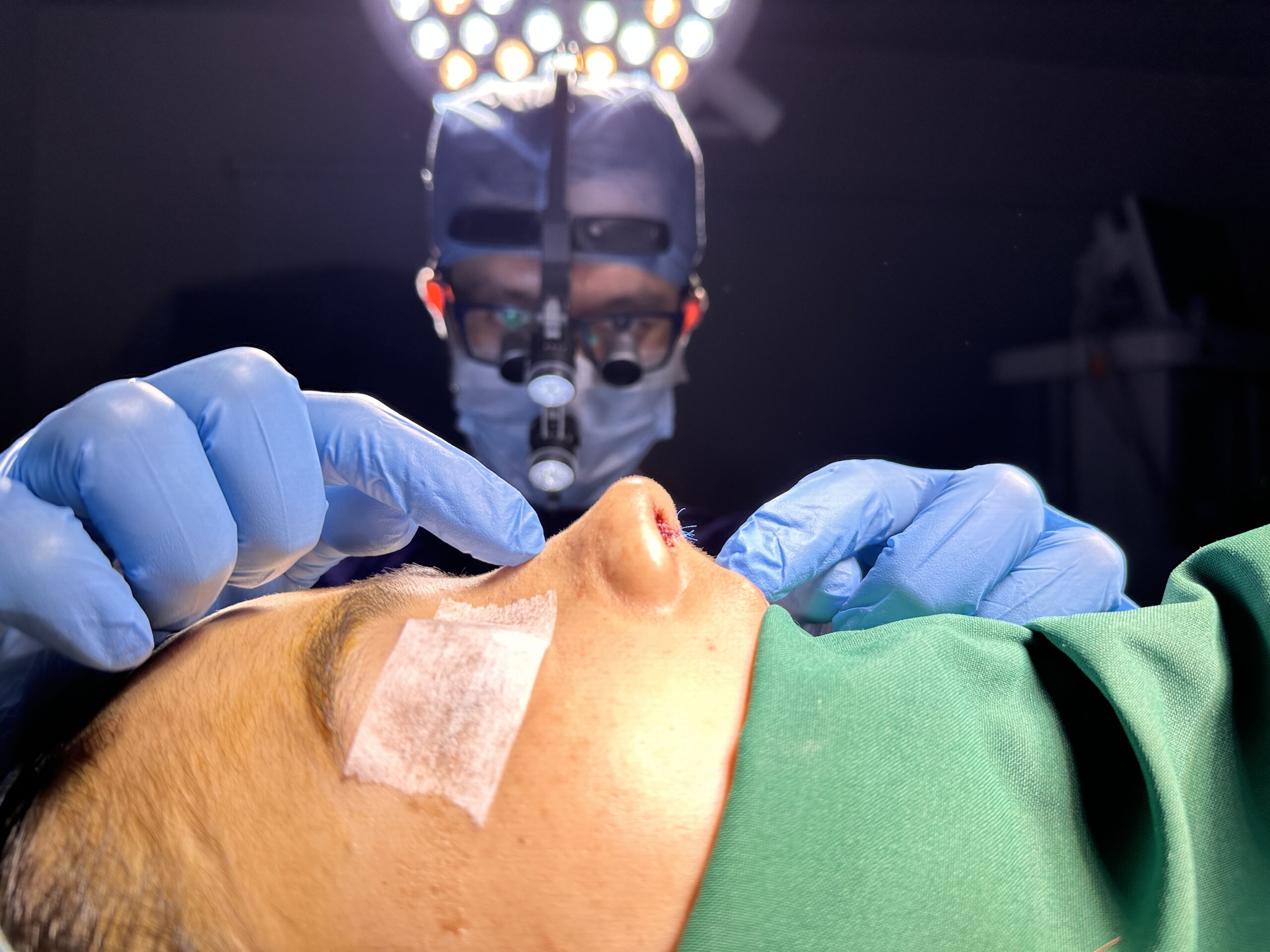Dr Rahul Gogoi operating on a rhinoplasty case at his RGIMS clinic in Guwahati