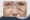 Cosmetic Surgery