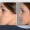 What Is Nose Surgery and Why Do People Choose It?