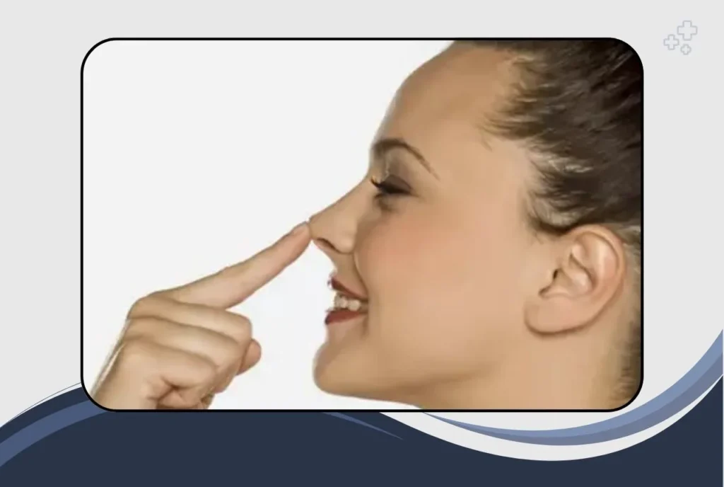 What to Expect After Nose Surgery