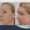 What Is a Facelift?