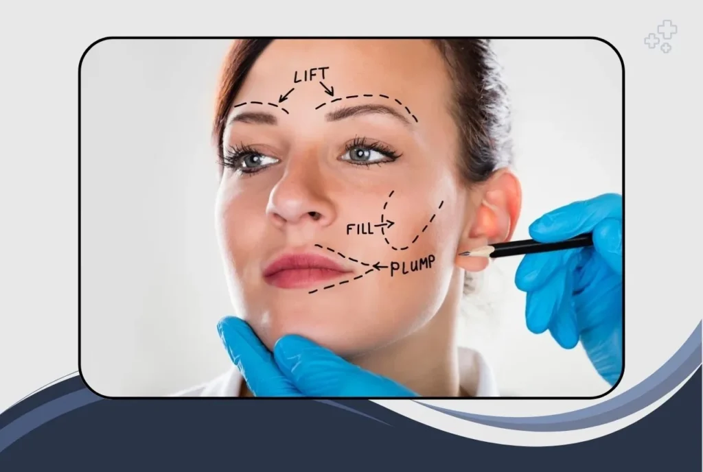 Types of Facelift Procedures