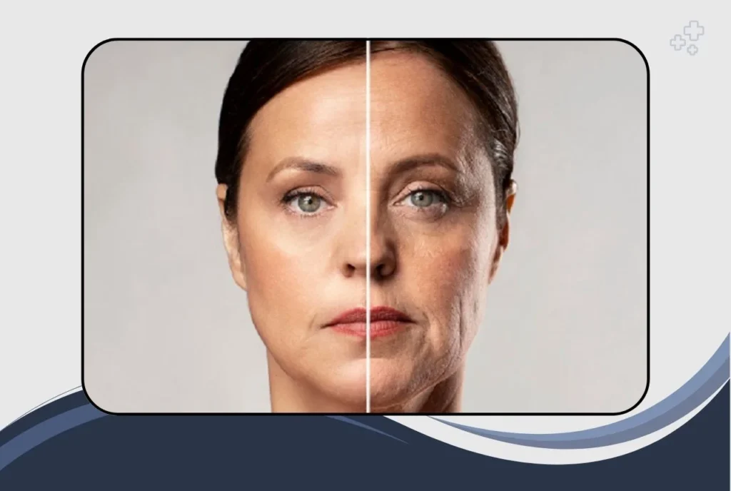 Who Is a Good Candidate for Facelift Surgery?