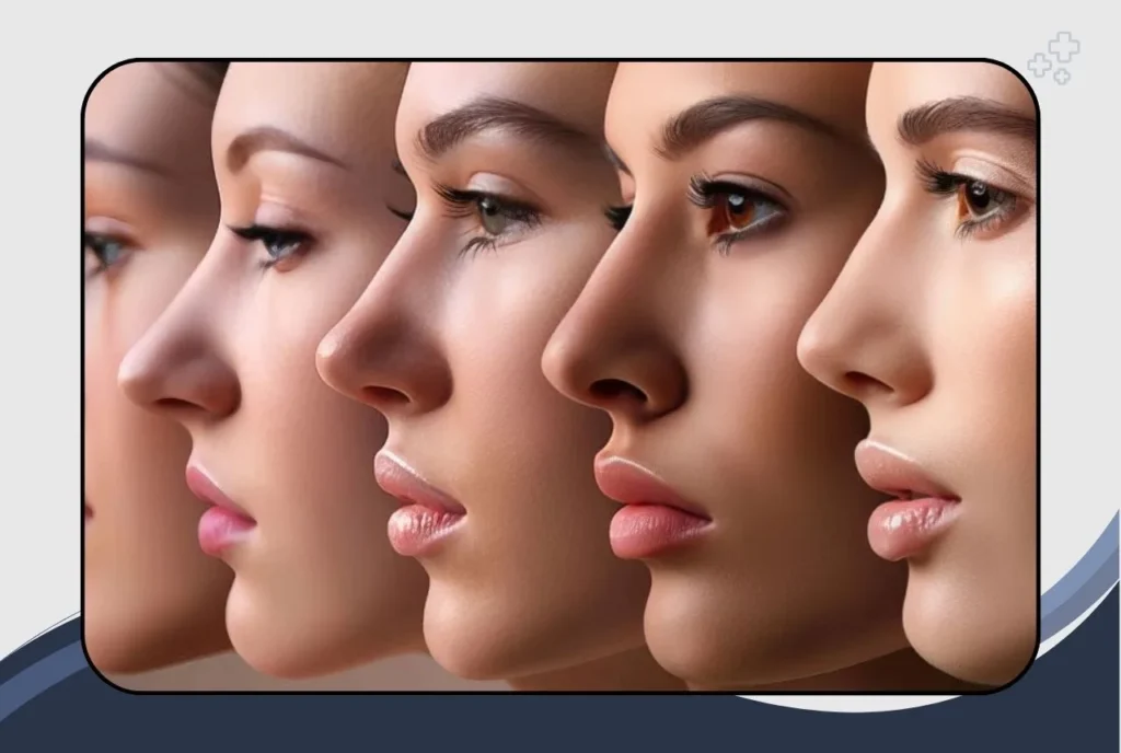 Different Types of Nose: A Guide to Nose Shape Types