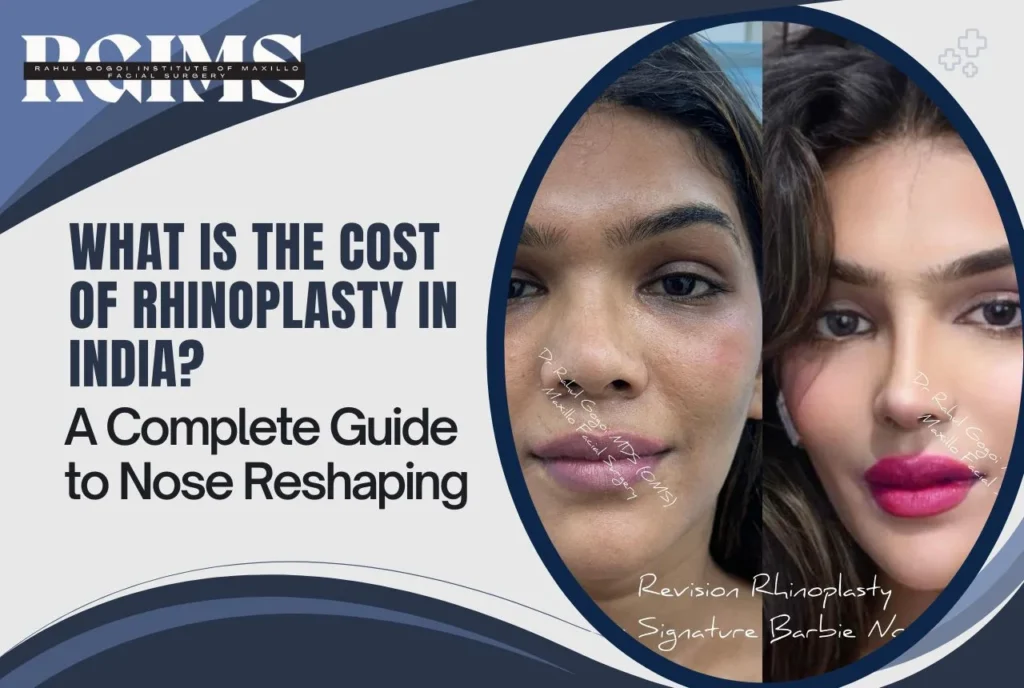 Image: What is the Cost of Rhinoplasty in India