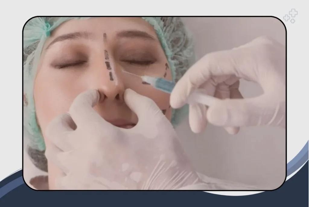 Why Choose Rhinoplasty in India?