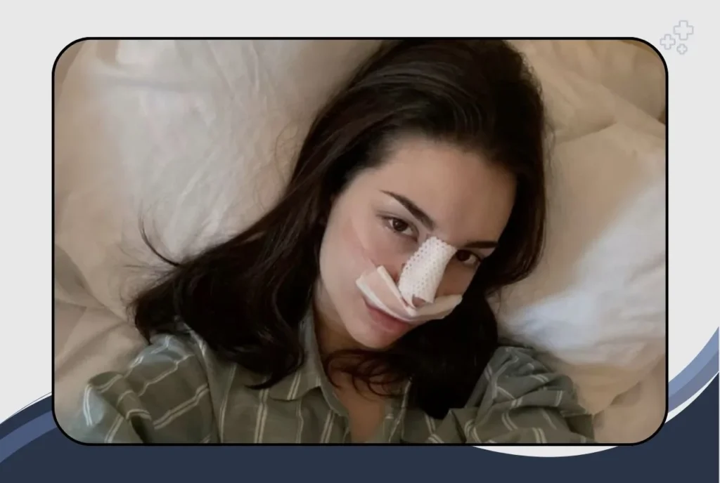 Recovery After Rhinoplasty