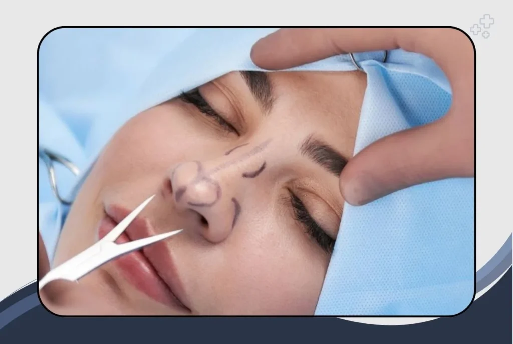 What Happens During the Rhinoplasty Procedure