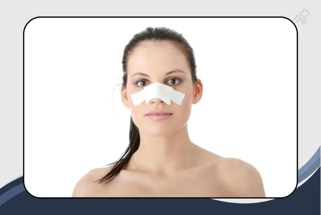 Recovery After Rhinoplasty
