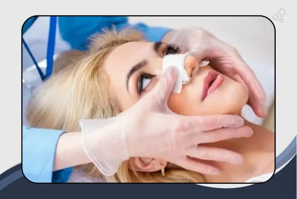 Risks Associated with Rhinoplasty