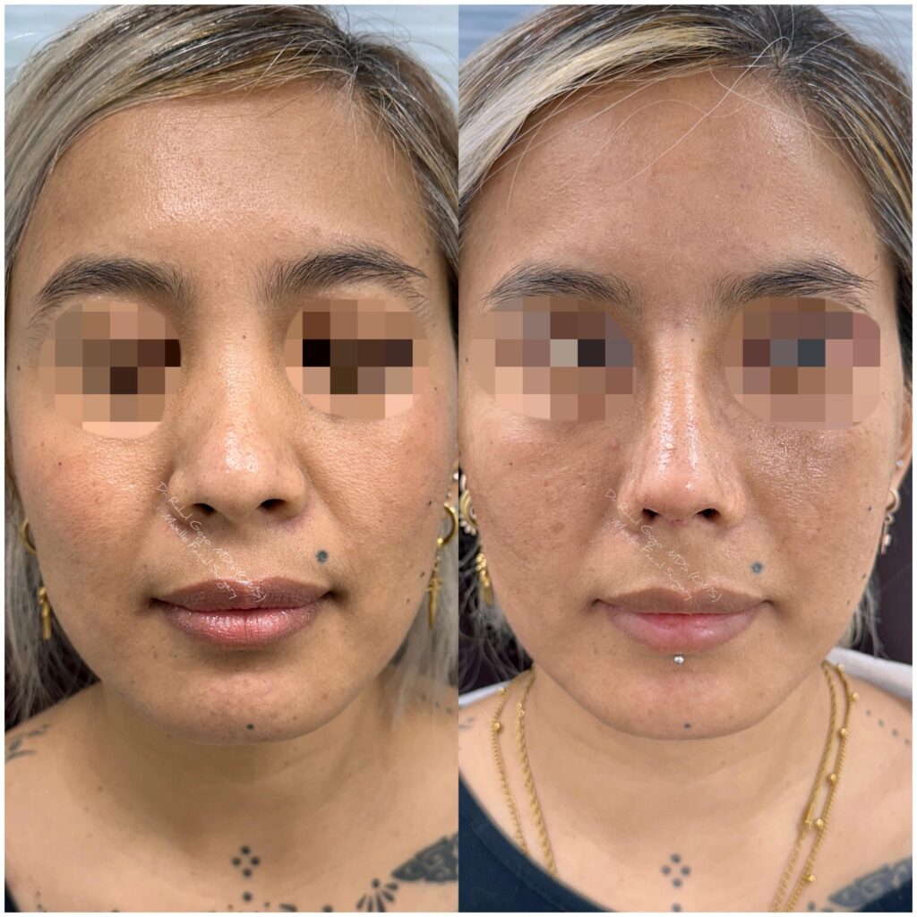plastic surgery in Northeast India